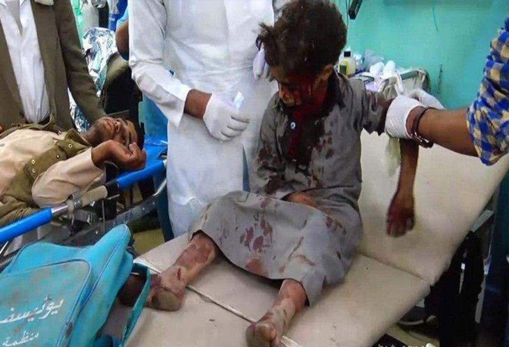  نماینده یونیسف شوکه از کودک کشی ائتلاف سعودی در صعده یمن 