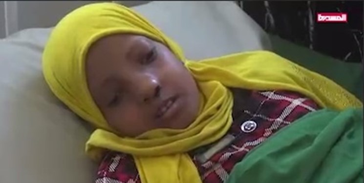  افزایش ابتلای کودکان یمنی به سرطان در نتیجه سلاح های ممنوعه متجاوزان