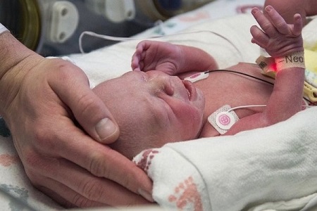 تولد نوزادی با رحم پیوندی در آمریکا