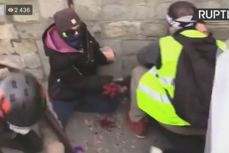 بر اثر انفجار نارنجک پلیس دست معترض فرانسوی قطع شد