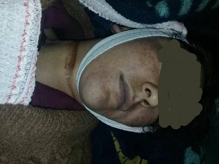 یک زن جوان توسط شوهرش در هرات به قتل رسید