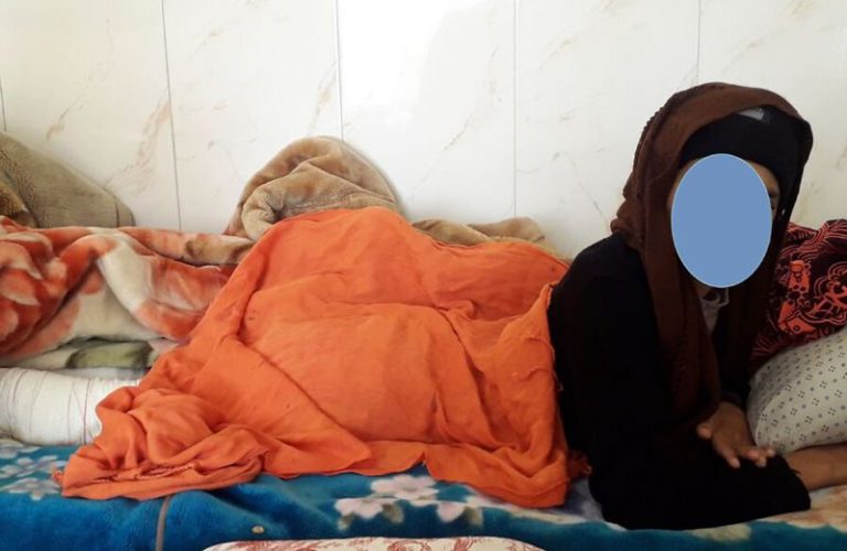  یک زن در هرات مورد خشونت فیجع توسط شوهرش قرار گرفته است